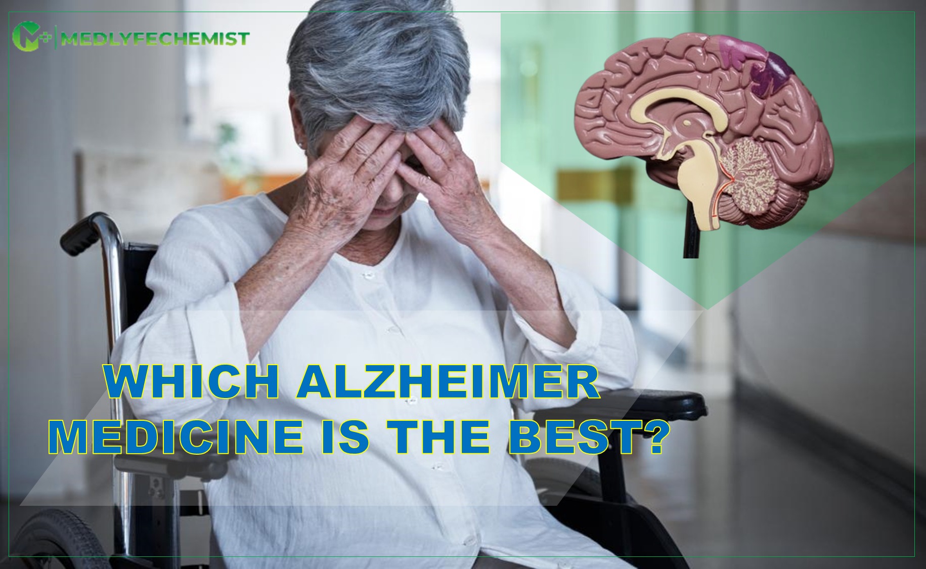 Which Alzheimer’s medicine is the best?